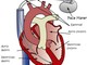 Salute: il pace-maker un piccolo, intelligente salvavita