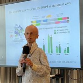 Progeria, cos'è la malattia di cui soffriva Sammy Basso