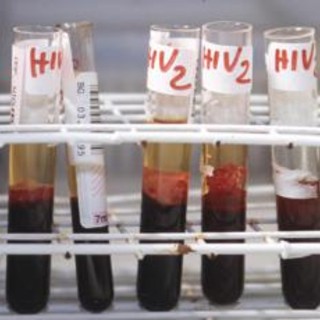 Aids, un'iniezione due volte all'anno può prevenire l'Hiv